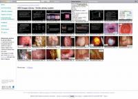 Hospital Website - The AIDS Images Library